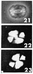 Watznaueria bayackii 11638