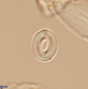 Watznaueria tubulata 12880