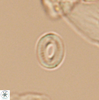 Watznaueria tubulata 12880