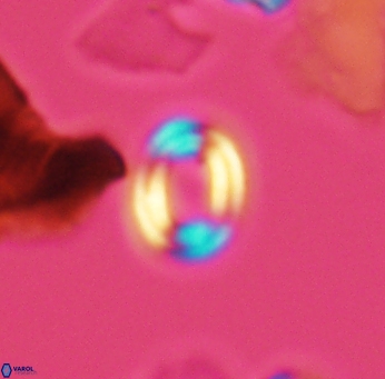 Watznaueria tubulata 2666