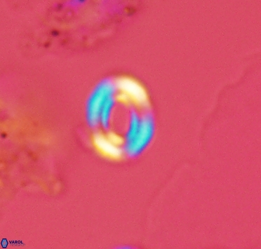 Watznaueria tubulata 2909
