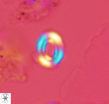 Watznaueria tubulata 2909