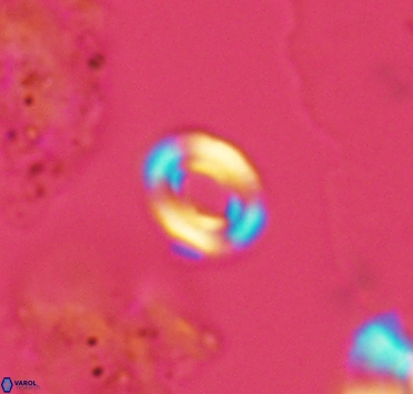 Watznaueria tubulata 2910