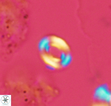 Watznaueria tubulata 2910
