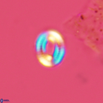 Watznaueria tubulata 3600
