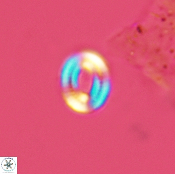 Watznaueria tubulata 3600