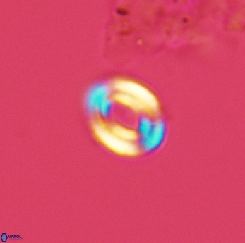 Watznaueria tubulata 3601