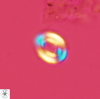 Watznaueria tubulata 3601