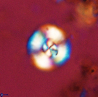 Watznaueria angustoralis 48271