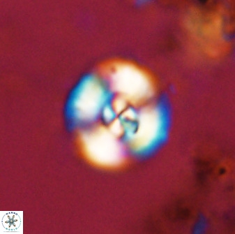 Watznaueria angustoralis 48271