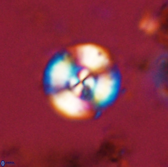 Watznaueria angustoralis 48272