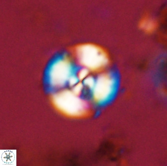 Watznaueria angustoralis 48272