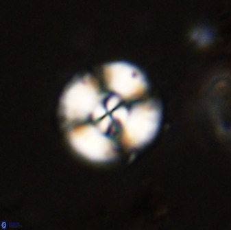 Watznaueria angustoralis 48273