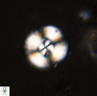 Watznaueria angustoralis 48273