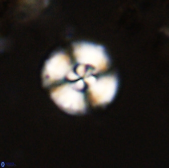 Watznaueria angustoralis 48274