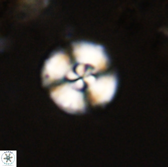 Watznaueria angustoralis 48274