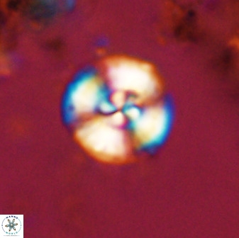 Watznaueria angustoralis 48275