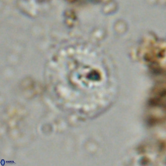 Watznaueria angustoralis 48276