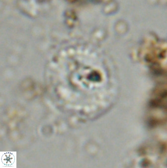 Watznaueria angustoralis 48276
