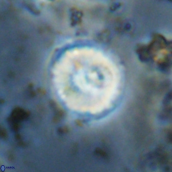 Watznaueria angustoralis 48277