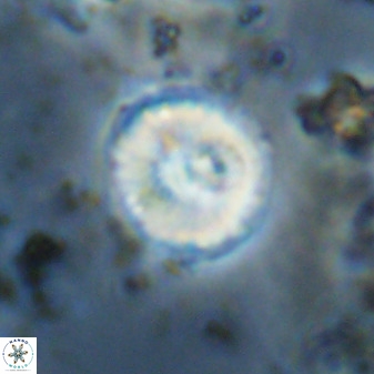 Watznaueria angustoralis 48277