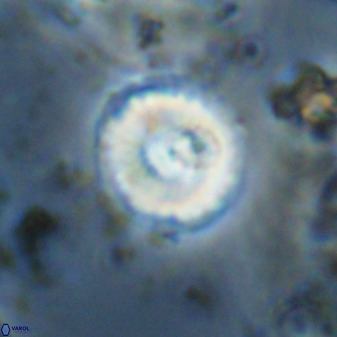 Watznaueria angustoralis 48278
