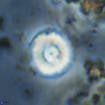 Watznaueria angustoralis 48280