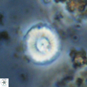 Watznaueria angustoralis 48280