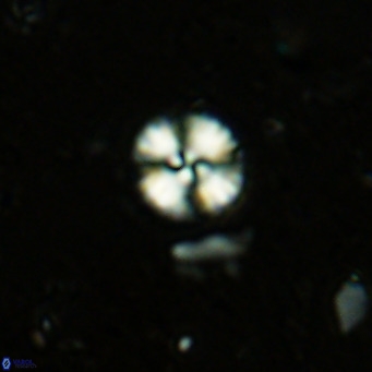 Watznaueria angustoralis VR 12921