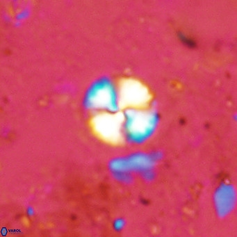 Watznaueria angustoralis VR 12922