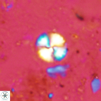 Watznaueria angustoralis VR 12922