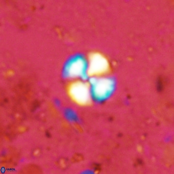 Watznaueria angustoralis VR 12924