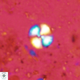 Watznaueria angustoralis VR 12924