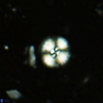 Watznaueria angustoralis VR 12925