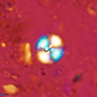 Watznaueria angustoralis VR 12926
