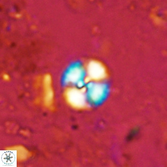Watznaueria angustoralis VR 12926