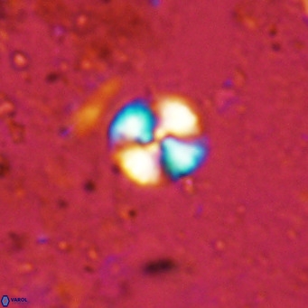 Watznaueria angustoralis VR 12928