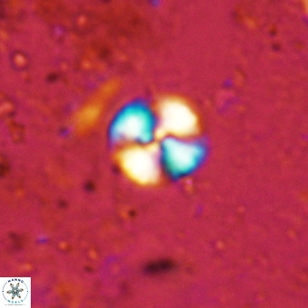 Watznaueria angustoralis VR 12928