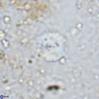 Watznaueria angustoralis VR 12929