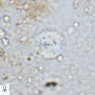 Watznaueria angustoralis VR 12929