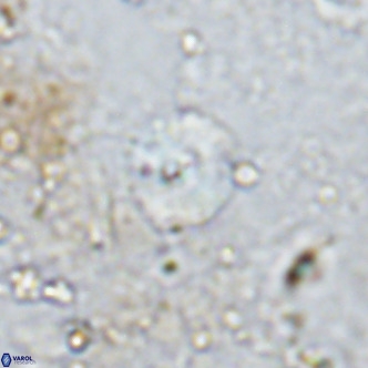 Watznaueria angustoralis VR 12930