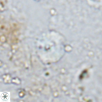 Watznaueria angustoralis VR 12930