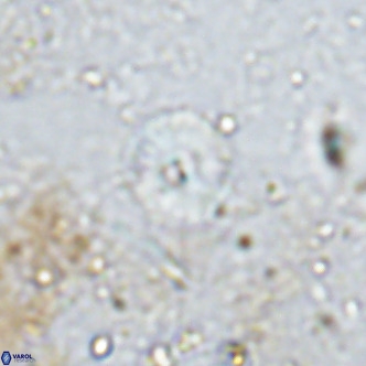 Watznaueria angustoralis VR 12931
