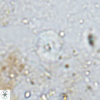 Watznaueria angustoralis VR 12931