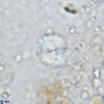 Watznaueria angustoralis VR 12932