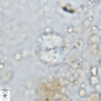 Watznaueria angustoralis VR 12932