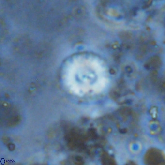 Watznaueria angustoralis VR 12933