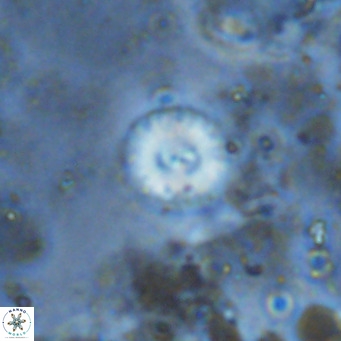 Watznaueria angustoralis VR 12933