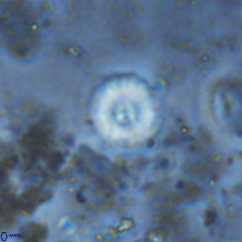 Watznaueria angustoralis VR 12934