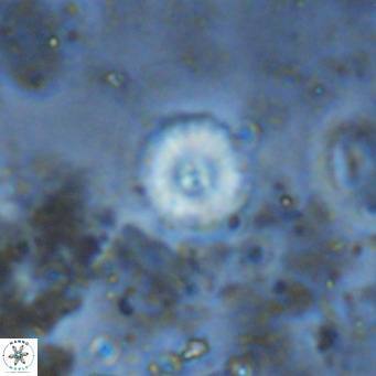 Watznaueria angustoralis VR 12934